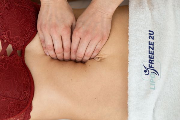 diastasis recti treatment Hounslow