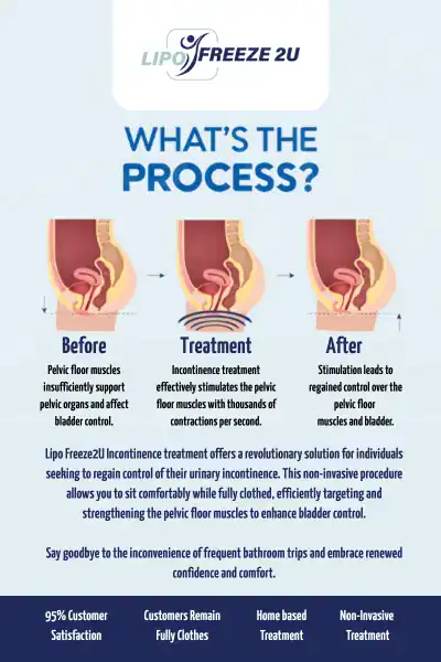 Diagram of how incontinence treatment Hounslow works.