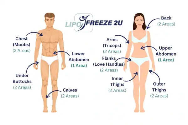 Areas you can have fat freezing treatment Hounslow