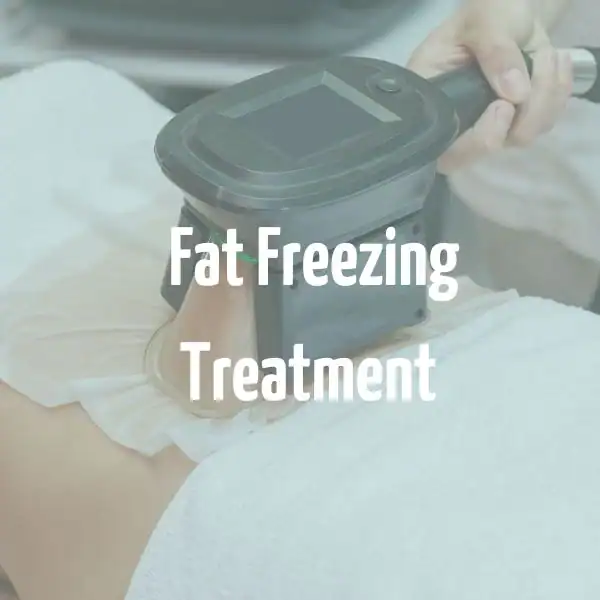 fat freezing treatment Hounslow