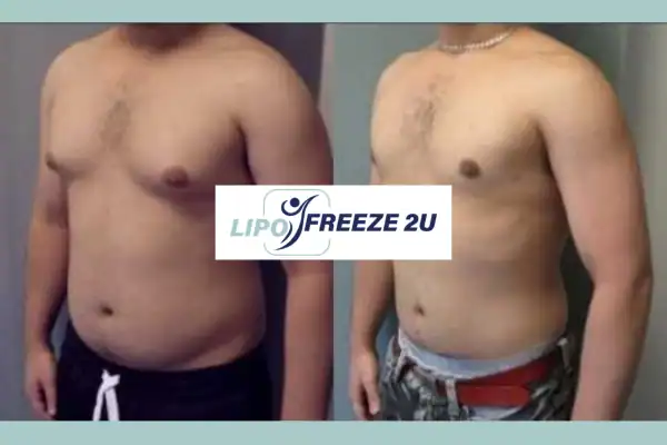 How Long Does It Take to See Results Hounslow?