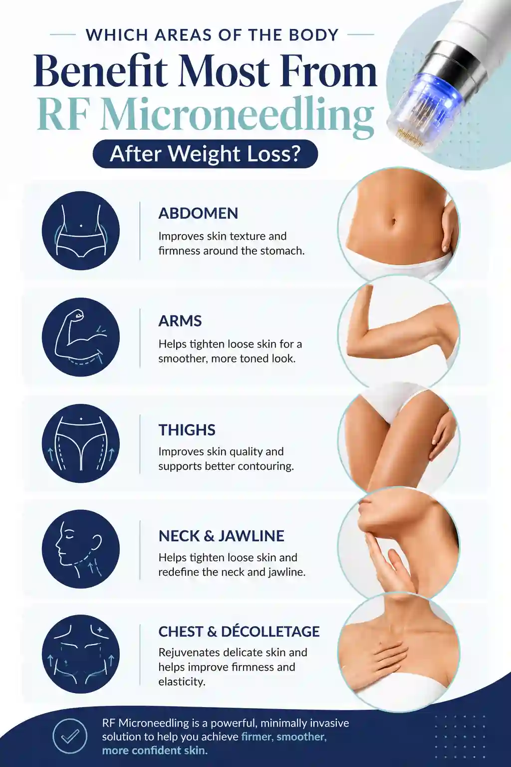 Which Areas of the Body Benefit Most From RF Microneedling After Weight Loss Hounslow